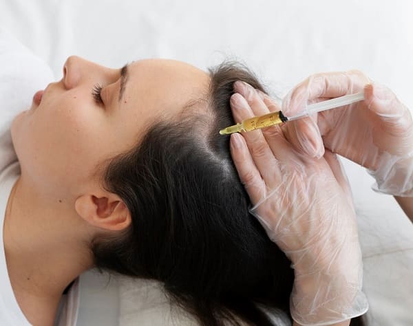 Hair restoration treatment in Nepal