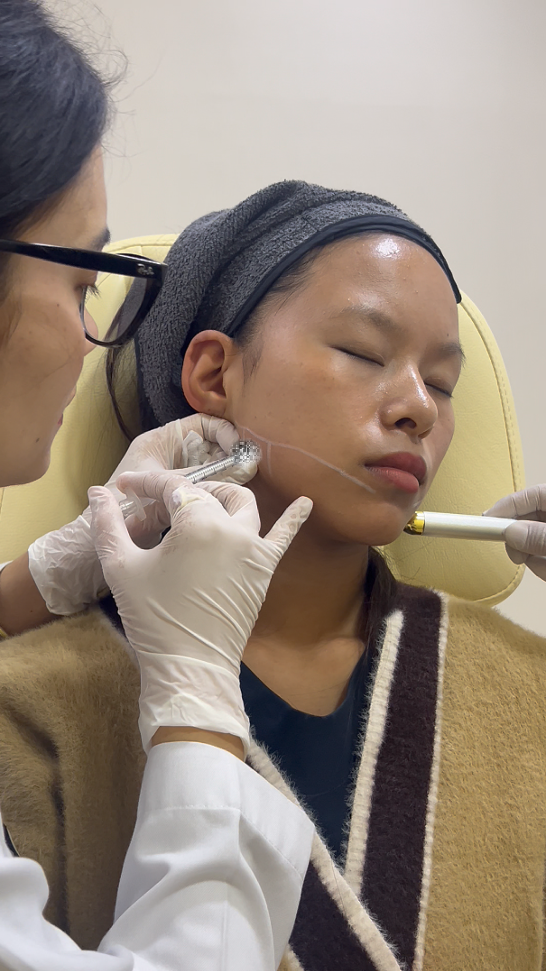 botox facial injection mapping in nepal