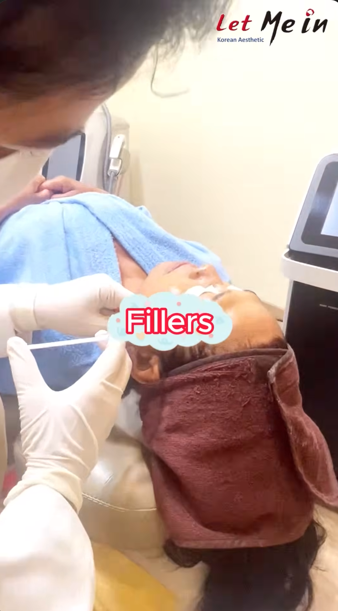 dermal filler treatment kathmandu nepal let me in