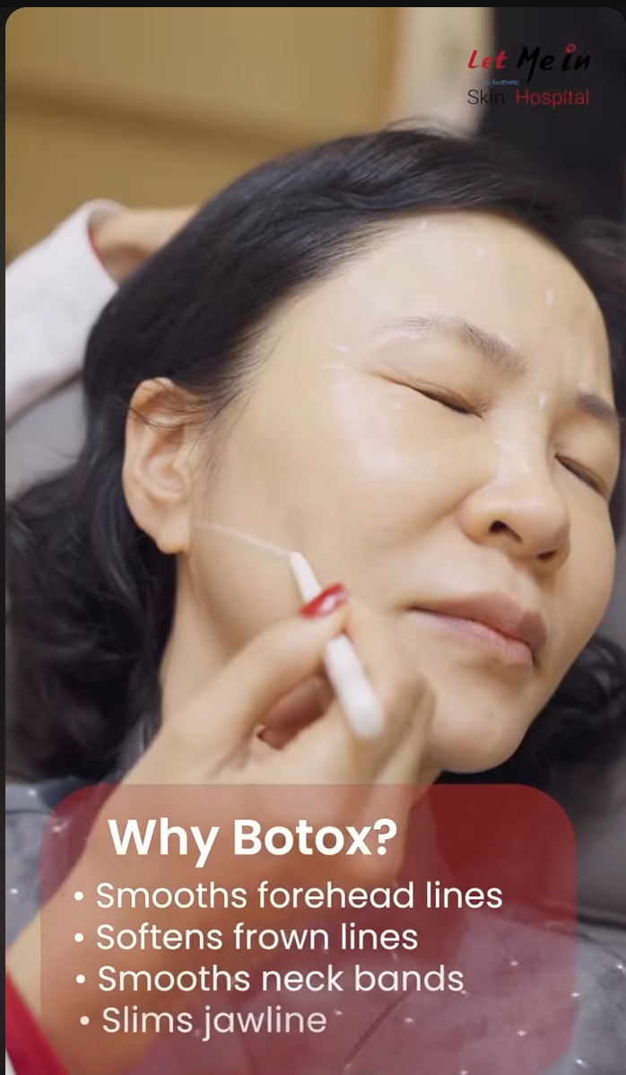 botox treatment in kathmandu nepal let me in