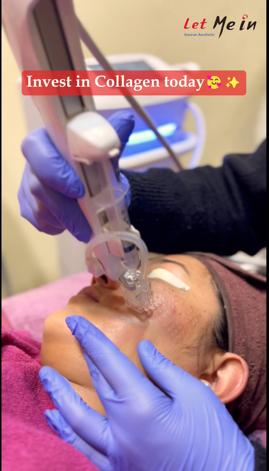 Collagen facial treatment in Nepal at Let Me In Clinic