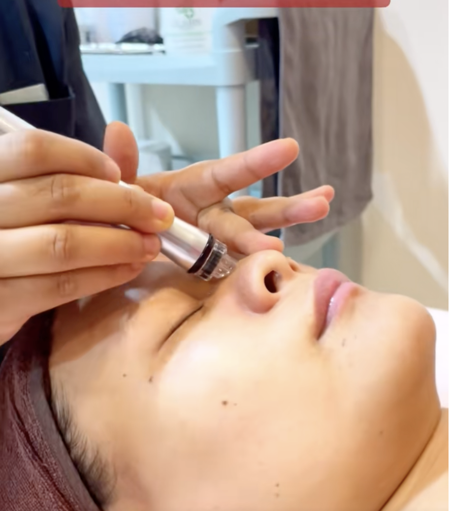 Hydrafacial in Kathmandu Nepal at Let Me In Clinic