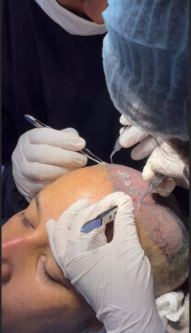 Hair transplant treatment page image