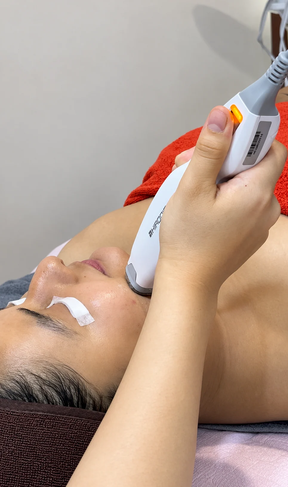 Clinical acne treatment in Nepal