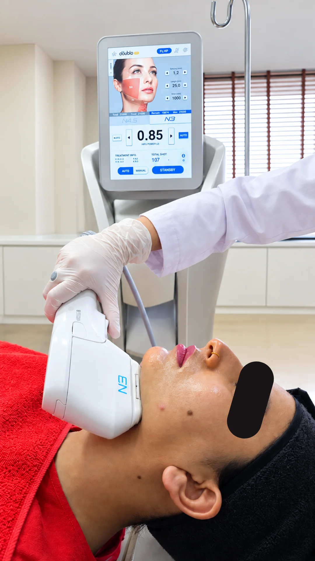 HIFU treatment