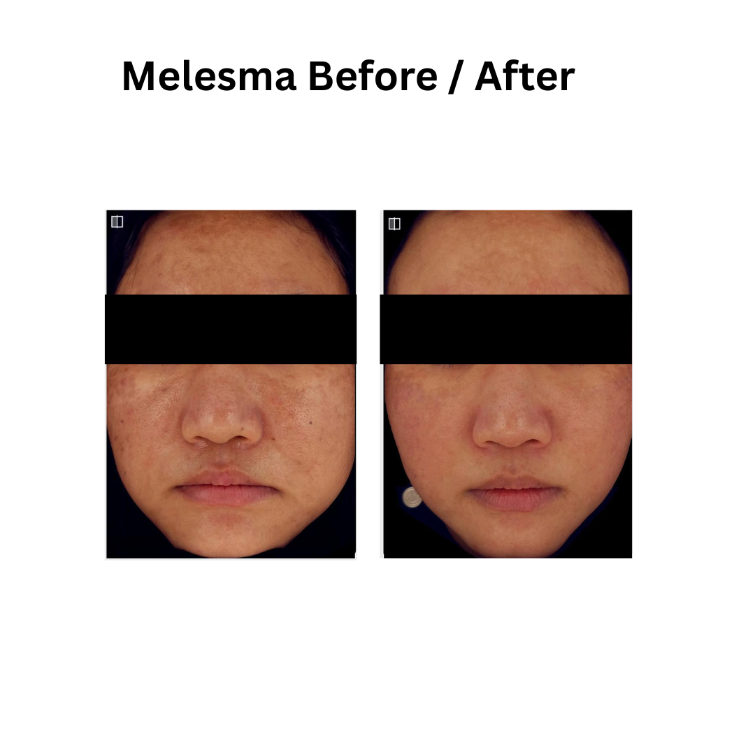 Skin conditions treatment in Nepal