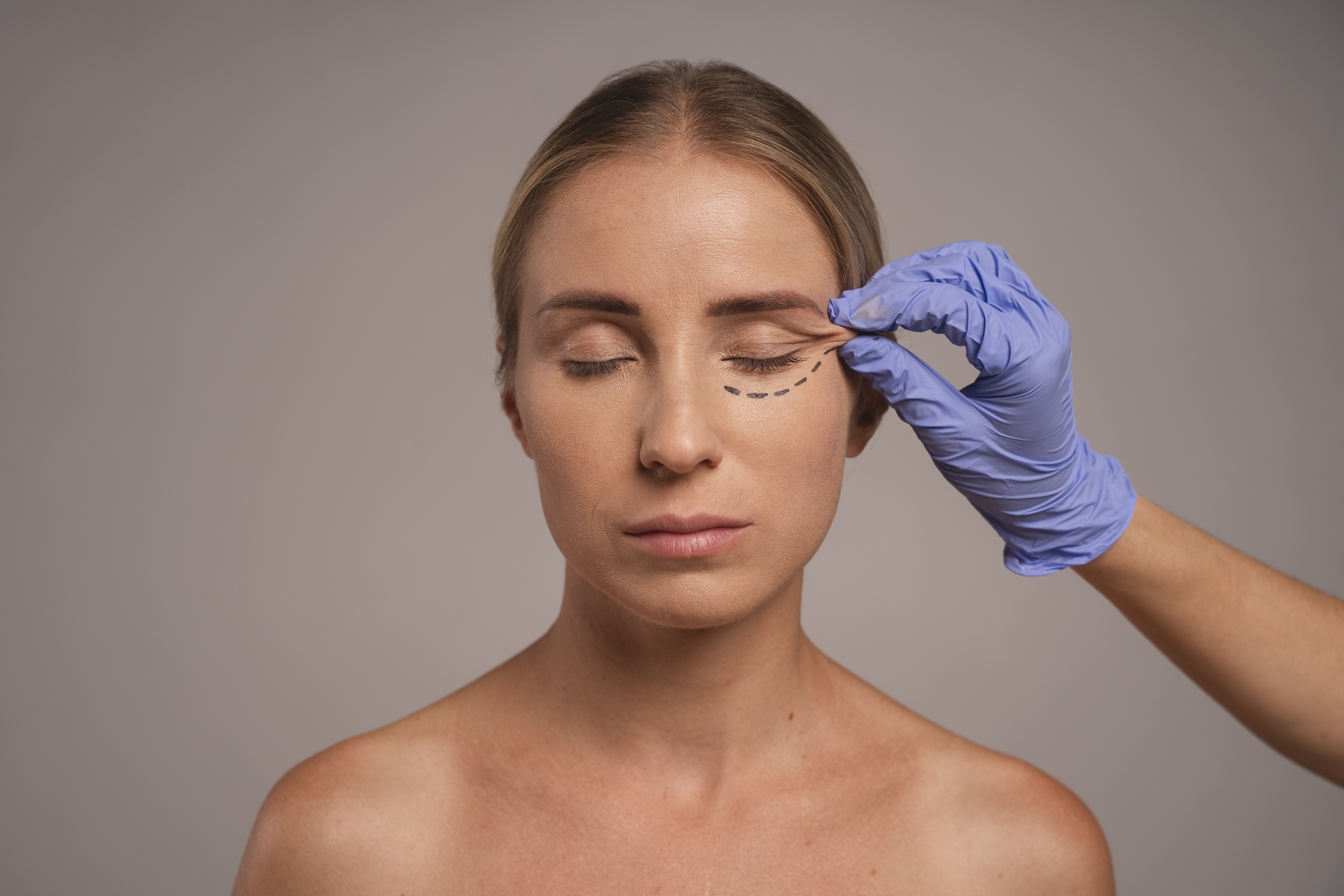 Lower eyelid blepharoplasty