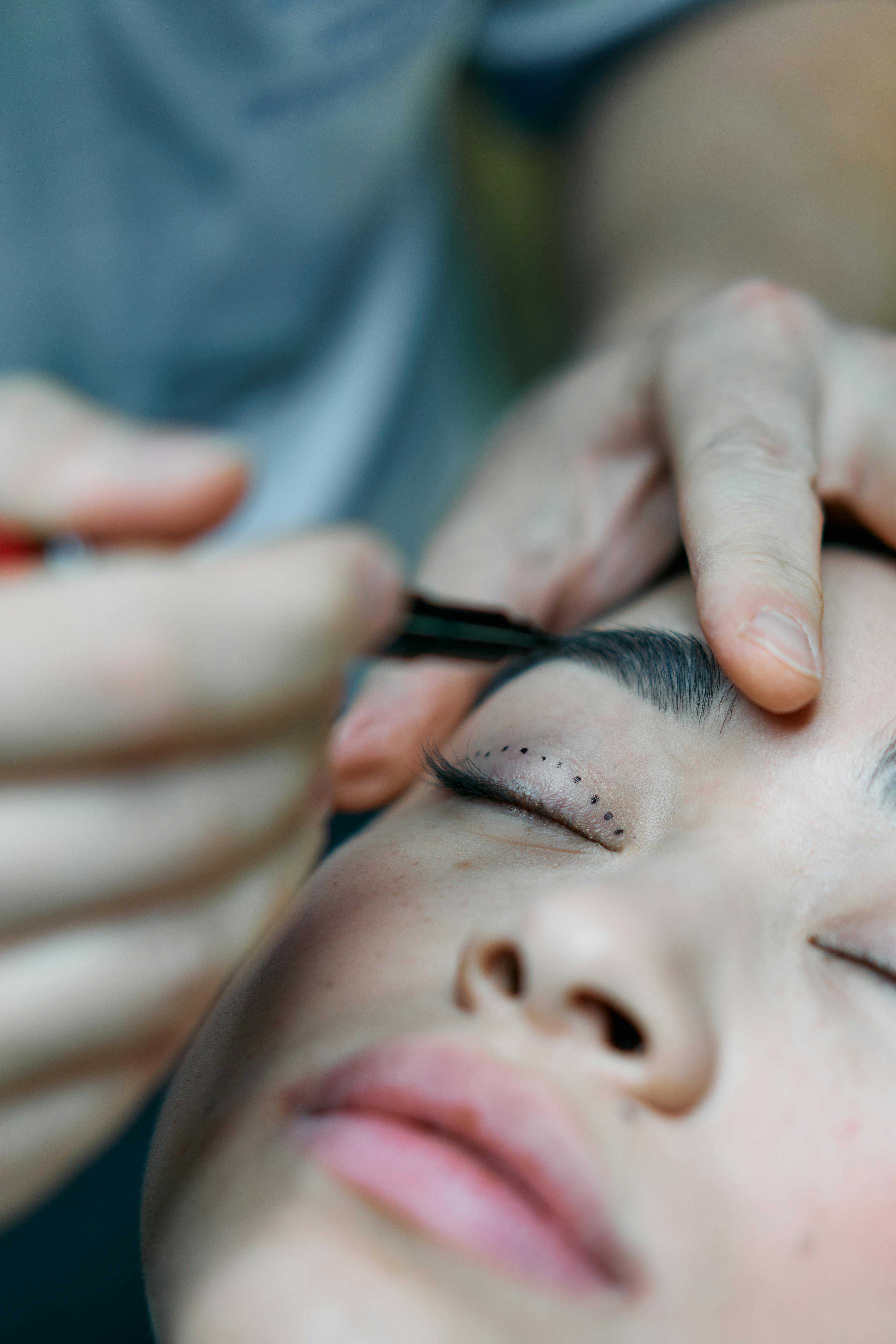 Upper eyelid blepharoplasty