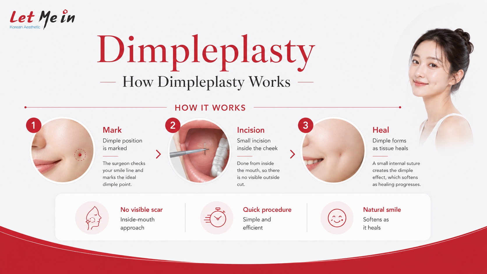 Dimpleplasty procedure in Kathmandu Nepal