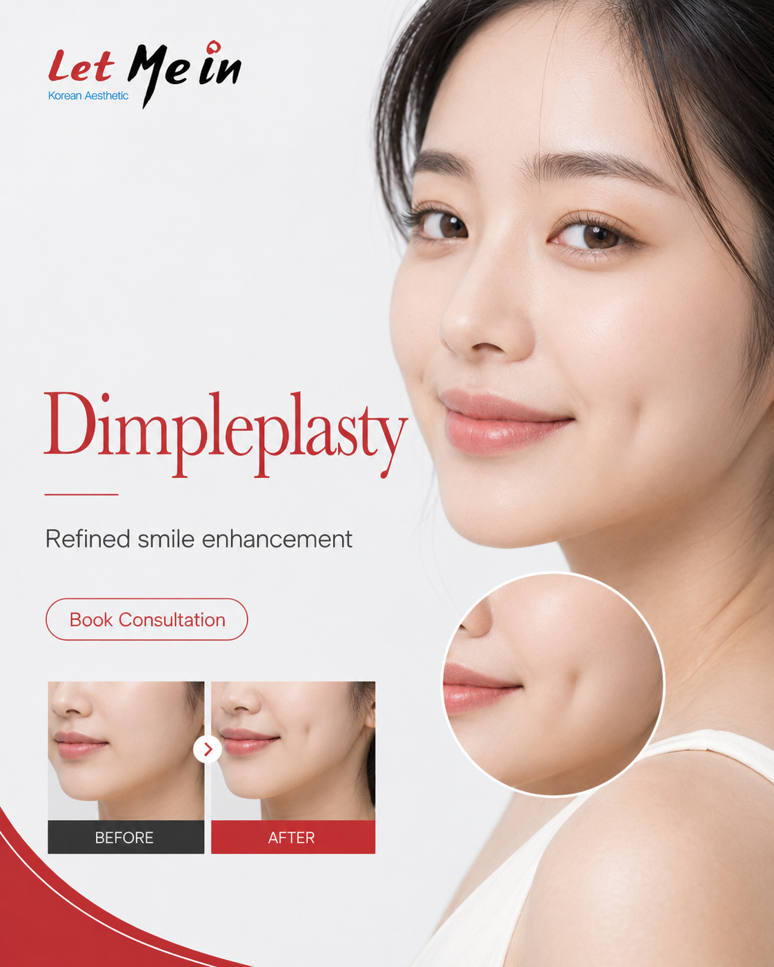 Dimpleplasty procedure in Kathmandu