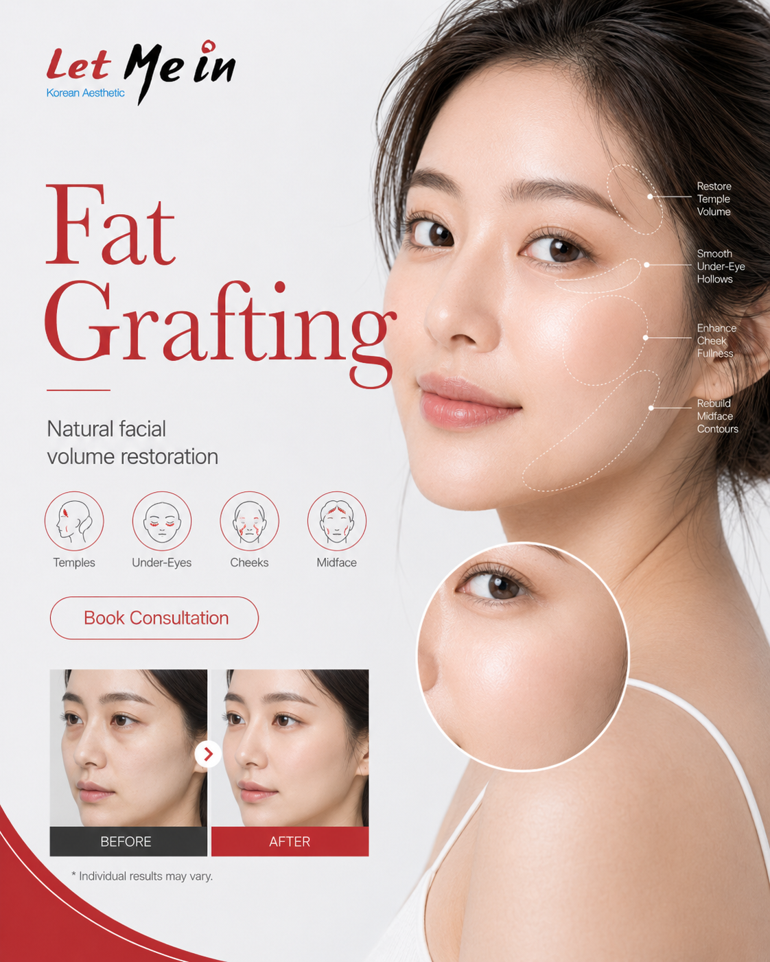 Fat grafting treatment in Nepal