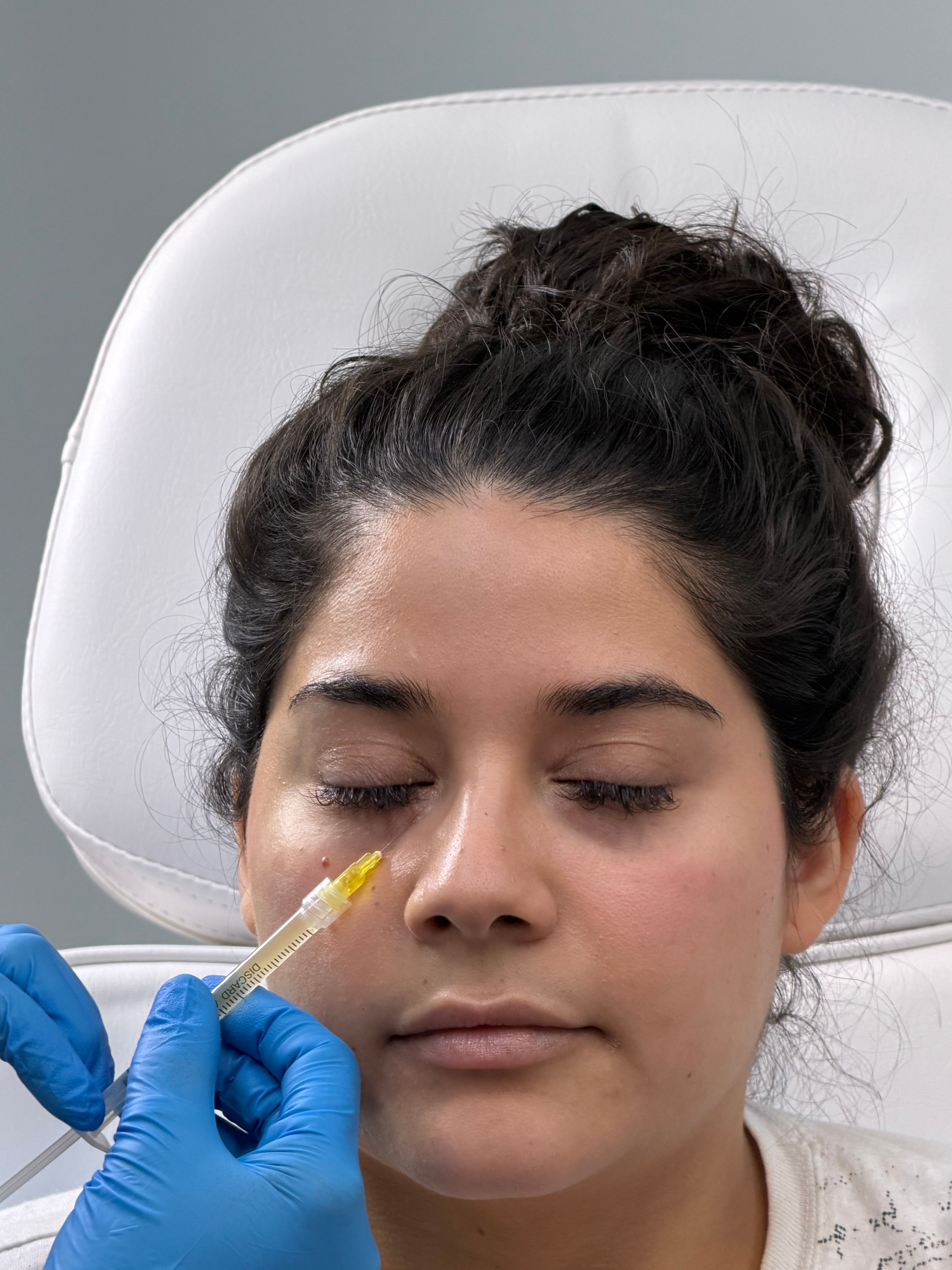 Plastic surgery in Kathmandu Nepal
