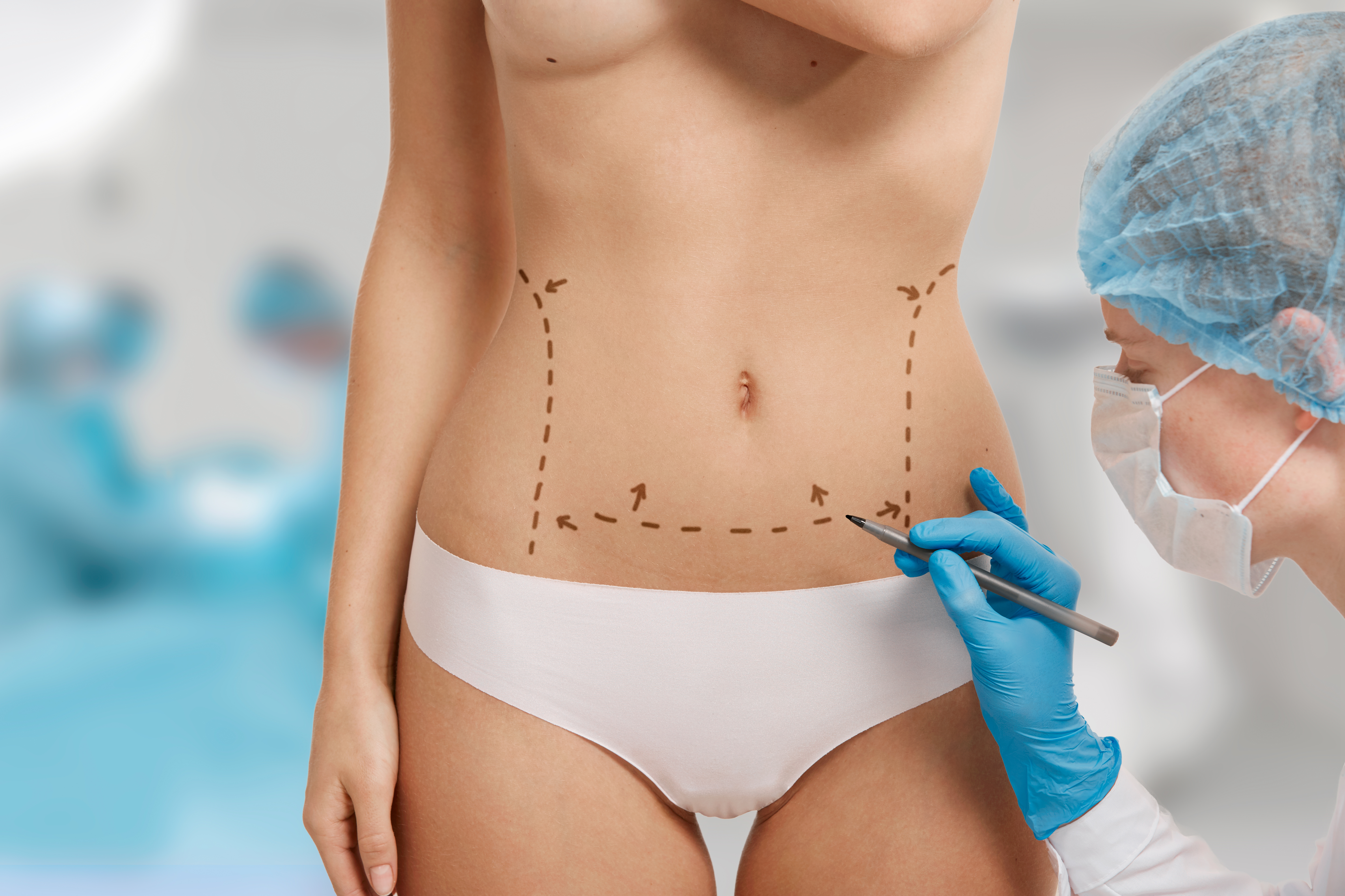 Minor liposuction in Nepal