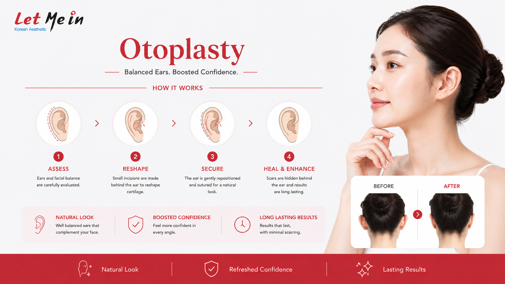 Ear reshaping surgery process infographic