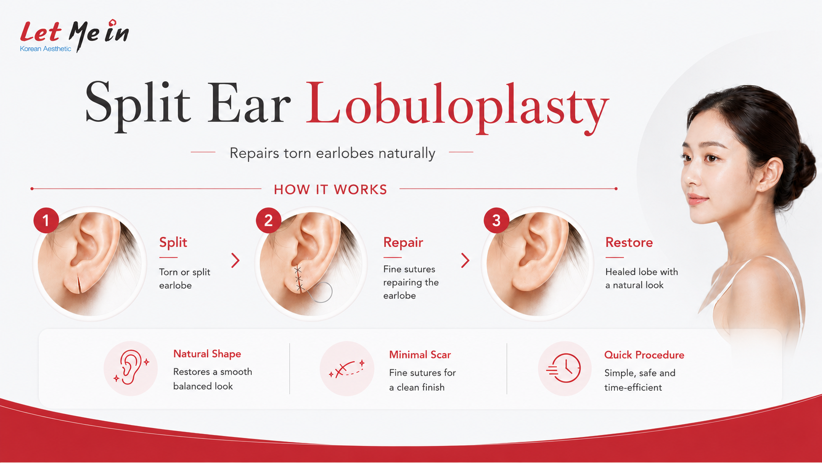 Lobuloplasty split earlobe repair overview