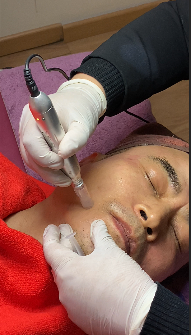 GFC Skin Booster