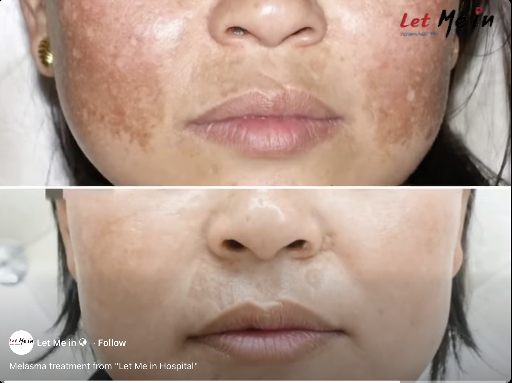 Medical skin condition treatment in Nepal