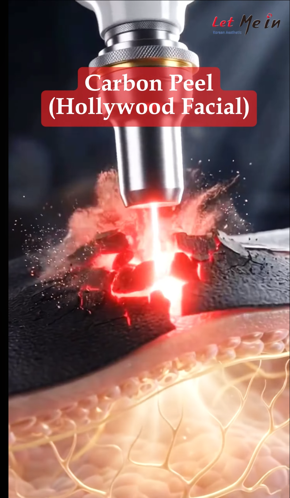 Carbon Peel in Nepal consultation