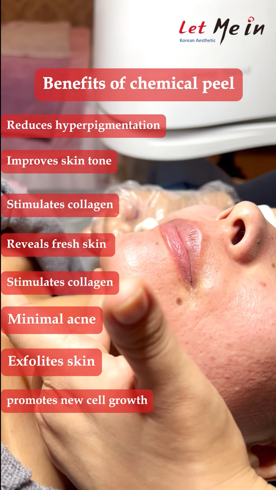 Chemical Peel Kathmandu at Let Me In clinic